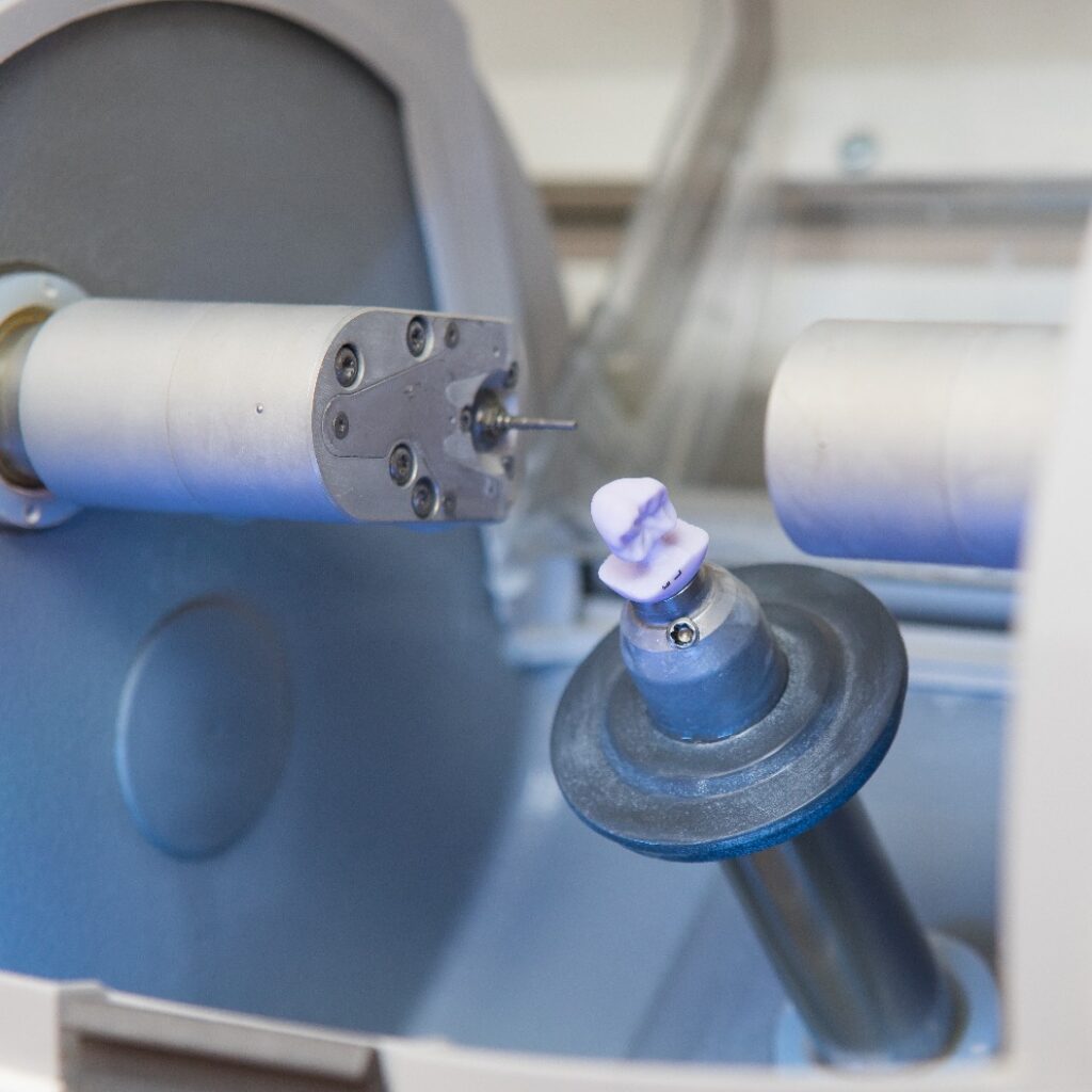 Fertiges Zahnimplantat, hergestellt mit dem CEREC-Fräsgerät in der Zahnarztpraxis